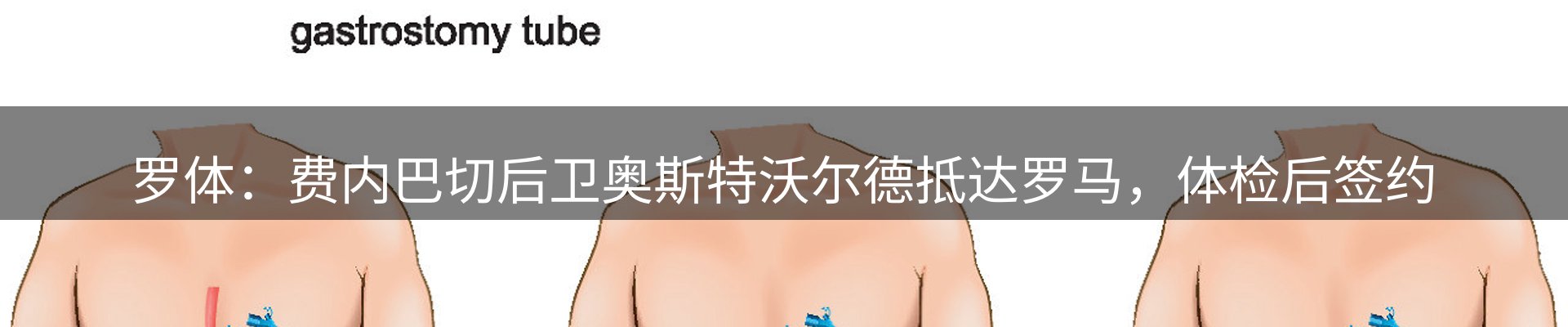 体育资讯